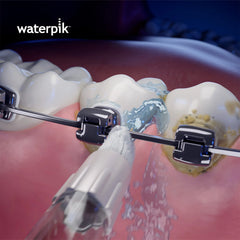Whitening Orthodontic Tip